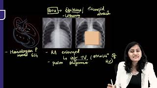 RADIOLOGY RAPID REVISION PART 02 FMGE INICET NEET PG [upl. by Achilles59]