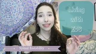 Living with EDS Spinal Instability [upl. by Emeric]