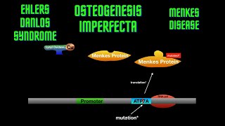 USMLE Step 1  Lesson 23  Osteogenesis Imperfecta Ehlers Danlos Syndrome and Menkes disease [upl. by Horton]