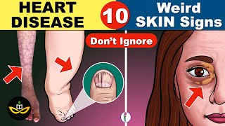 10 Unexpected Signs of Heart Disease that you Must Know [upl. by Llerret724]