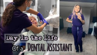 What is it like to work as a Dental Assistant [upl. by Zzaj]