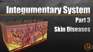 Integumentary System Part 3 of 3 Diseases of the Skin [upl. by Bunker]