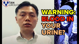 YOU Need To Know About Blood In The Urine  Spot The Warning Signs Early [upl. by Gibb]