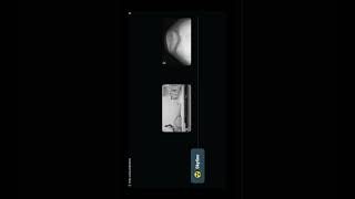 Radiographic Positioning of the Knee  8  Positions radiology quiz learningradiology شرح [upl. by Lertram]