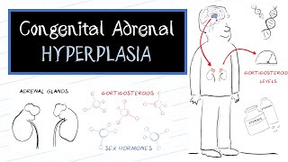 What is Congenital Adrenal Hyperplasia CAH [upl. by Aamsa]