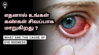 What Are The Common Causes Of Eye Redness In Tamil  தமிழ்  Empty Idea [upl. by Solange]