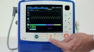 X Series® Synchronized Cardioversion English [upl. by France]