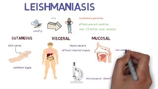 What is Leishmaniasis An introduction and overview [upl. by Htebilil111]