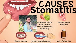 Stomatitis Chapter1 Disease1 AHN 3rd semester kmu slides in pashto drnajeebnote drnajeeb kmupdat [upl. by Myrlene]