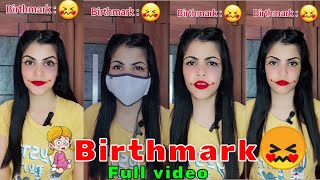 Full videoIf you are born with a strange Birthmark😢🤫 shorts viral trending [upl. by Scheck]