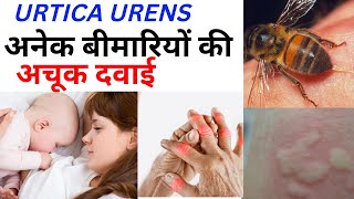 URTICA URENS HOMEOPATHIC MEDICINE अनेक बीमारियों की अचूक दवाई। [upl. by Nonnerb]