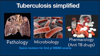 Tuberculosis simplified pathologymicrobiologypharmacology Quick revision for 2nd yr MBBS exams [upl. by Nerland]