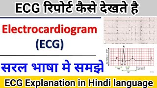 ECG report कैसे देखते है  Electrocardiogram explanation in hindi language [upl. by Vorfeld984]