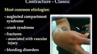 Volkmanns Ischemic Contracture Classic  Everything You Need To Know  Dr Nabil Ebraheim [upl. by Natam708]