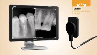 Dental Sensor  Owandy Visteo new concept in Digital Radiography [upl. by Ebsen]