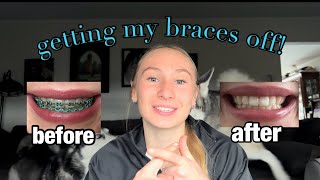 I GOT MY BRACES OFF [upl. by Desdee]