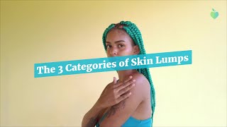 The 3 Categories of Skin Lumps [upl. by Hnid]