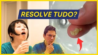 Como REMOVER CÁSEOS AMIGDALIANOS com GARGAREJOS comprovado [upl. by Aimit]