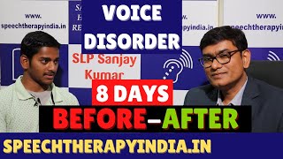 PrePost  Congested Arytenoids  8 Days  Voice Therapy  By SLP Sanjay Kumar  Since 2010 [upl. by Ybot]