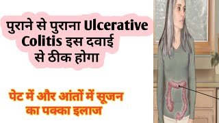 ulcerative colitis Treatment  Diet and yoga  Best Homeopathic medicine for U colitis  dr tarun [upl. by Balliett]