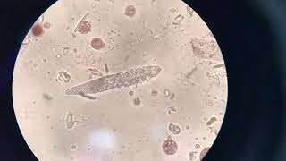 Demodex under the Microscope [upl. by Eirrol]