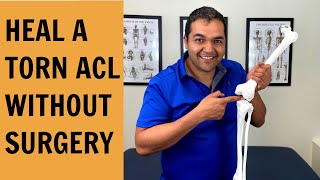 How To Test amp Heal A Torn ACL Without Surgery [upl. by Kirit245]