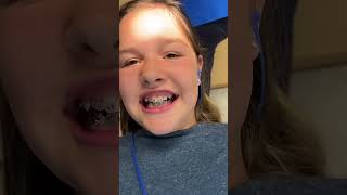 Braces kidslearning kidsfun [upl. by Tannenwald]