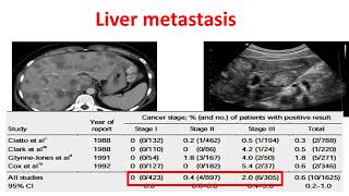 Breast cancer Staging workup part 22 Basics of Breast cancer course [upl. by Stolzer]