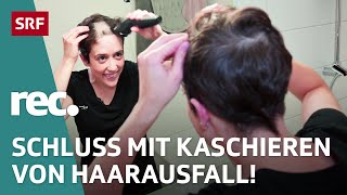 Haarausfall bei Frauen – Von Vorurteilen Schamgefühl und Weiblichkeit  Reportage  rec  SRF [upl. by Areip371]