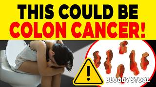 Warning Signs of Colon Cancer To Recognise Before Its Too Late [upl. by Naul]