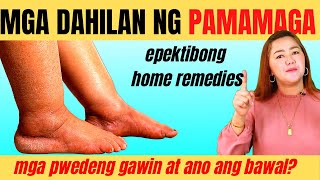 Pamamaga at Pamamanas sa Binti at Paa Anong Dapat Gawin at Ano ang Bawal  Doc Cherry [upl. by Lechner]