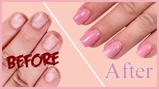 How to Fix Short Bitten Nails with Acrylic Powder  Easy tutorial [upl. by Alenas]