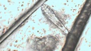 sarna demodex sarcoptes y tratamiento [upl. by Elocn199]