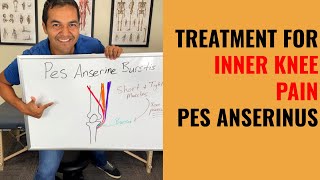 How To Cure Inner Knee Pain Caused By Pes Anserine Bursitis Easy Self Treatment That Works [upl. by Garceau]