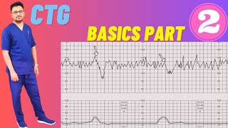 CTG Basics Part 2  CTG Monitoring in Pregnancy Fetal Cardiotocography [upl. by Yrehc105]