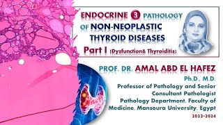 Thyroid dysfunction and thyroiditis  lecture شرح محاضرة [upl. by Leseil]