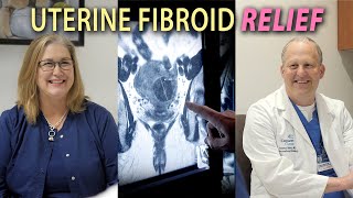 How are Uterine Fibroids Treated [upl. by Eudo]