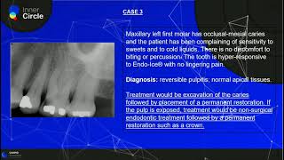 Pulp and Periapical Diagnosis  Endodontics  Radiographic Interpretation [upl. by Drofdeb]