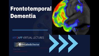 Frontotemporal Dementia [upl. by Kloster894]