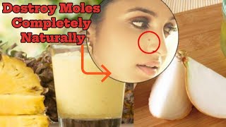 Destroy Your Moles Warts Blackheads Skin Tags And Age Spots Completely Naturally [upl. by Edeline175]