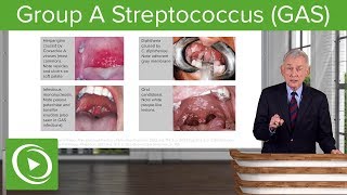 Group A Streptococcus GAS – Infectious Diseases  Lecturio [upl. by Lucas]