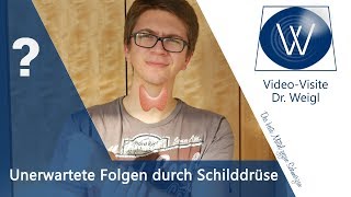 Kommen Ihre Kopfschmerzen Gelenkprobleme amp Rheuma von der Schilddrüse Karpaltunnelsyndrom QampA7 [upl. by Ailimac]