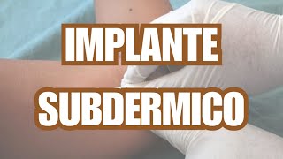 IMPLANTE SUBDERMICO  TODO LO QUE DEBES SABER ¿ES SEGURO ¿TIENE EFECTOS SECUNDARIOS [upl. by Ahsinan445]