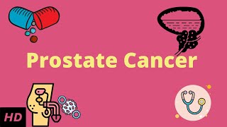 Prostrate Cancer Causes Signs and Symptoms DIagnosis and Treatment [upl. by Lexine64]