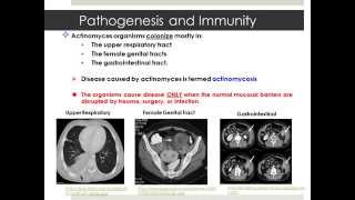 Actinomyces [upl. by Ginelle983]