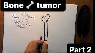 Bone tumor Pathalogy HINDI 🍖 GIANT CELL TUMORbenign and malignant part2 [upl. by Sinnylg]