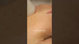 Mesoterapia inyectada 🆚 Mesoterapia virtual beauty piel tratamientoestetico cuidadopiel [upl. by Notserk]