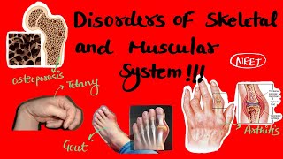 All Disorders of muscular and skeletal system  class 11 locomotion and movement neet [upl. by Roselle]