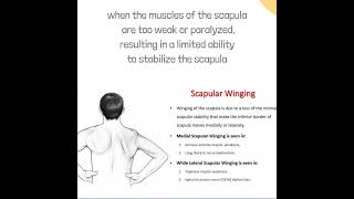 How to recover scapula winging from Physiotherapy bestdoctor physiotherapy scapula [upl. by Merkle]