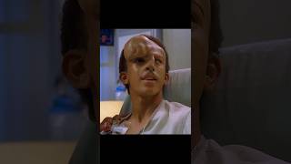 Guy had a tumor removed from his face😲😰 movie series [upl. by Nerte225]